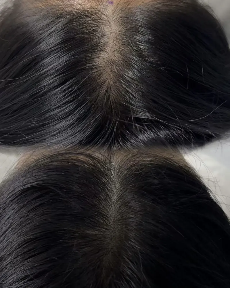 蒲欣老师纹发发缝填补案例 1
